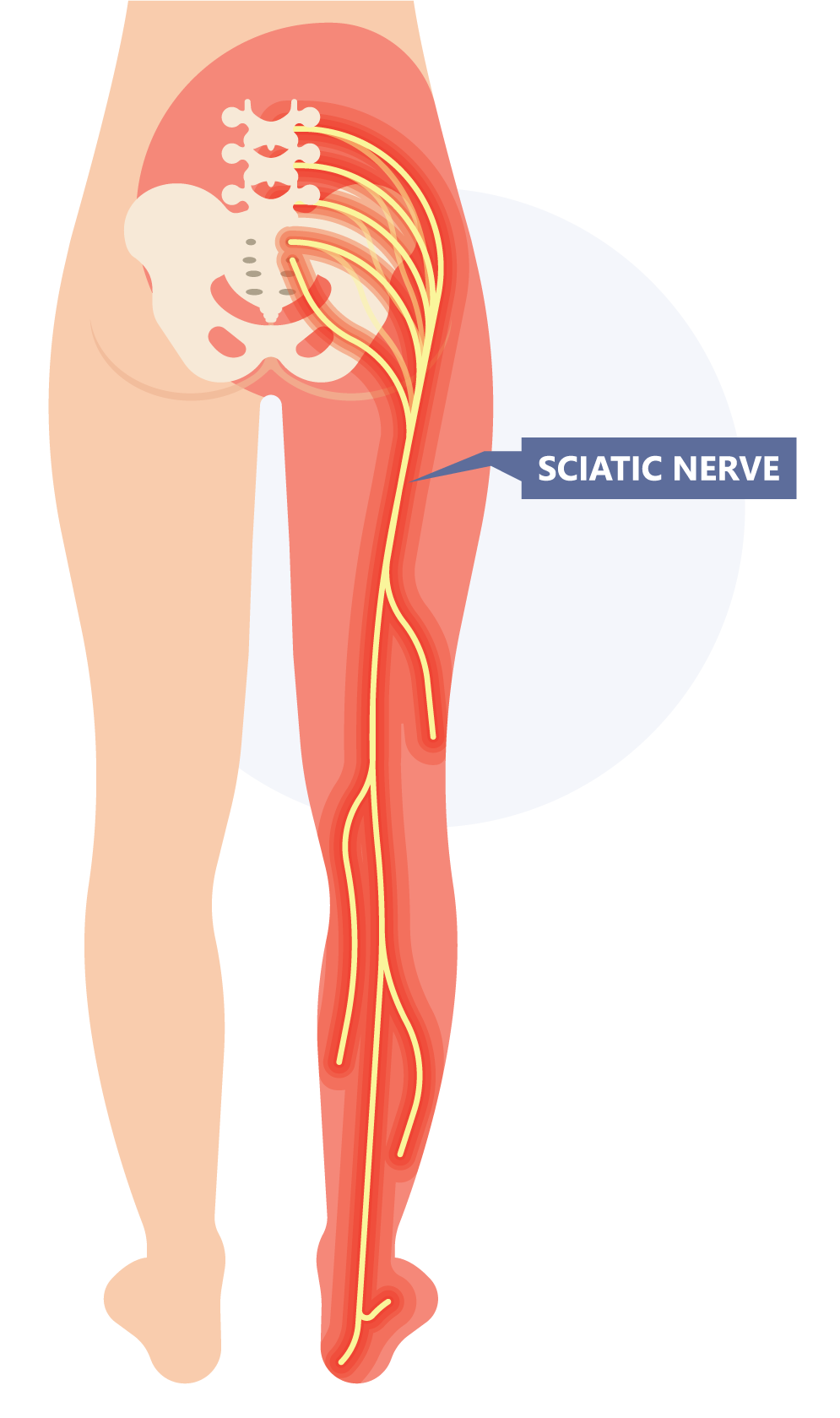 Chiropractic Singapore - Chiropractic for Sciatica Pain