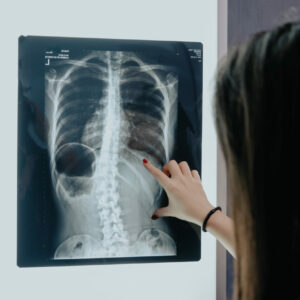 can scoliosis affect brain health