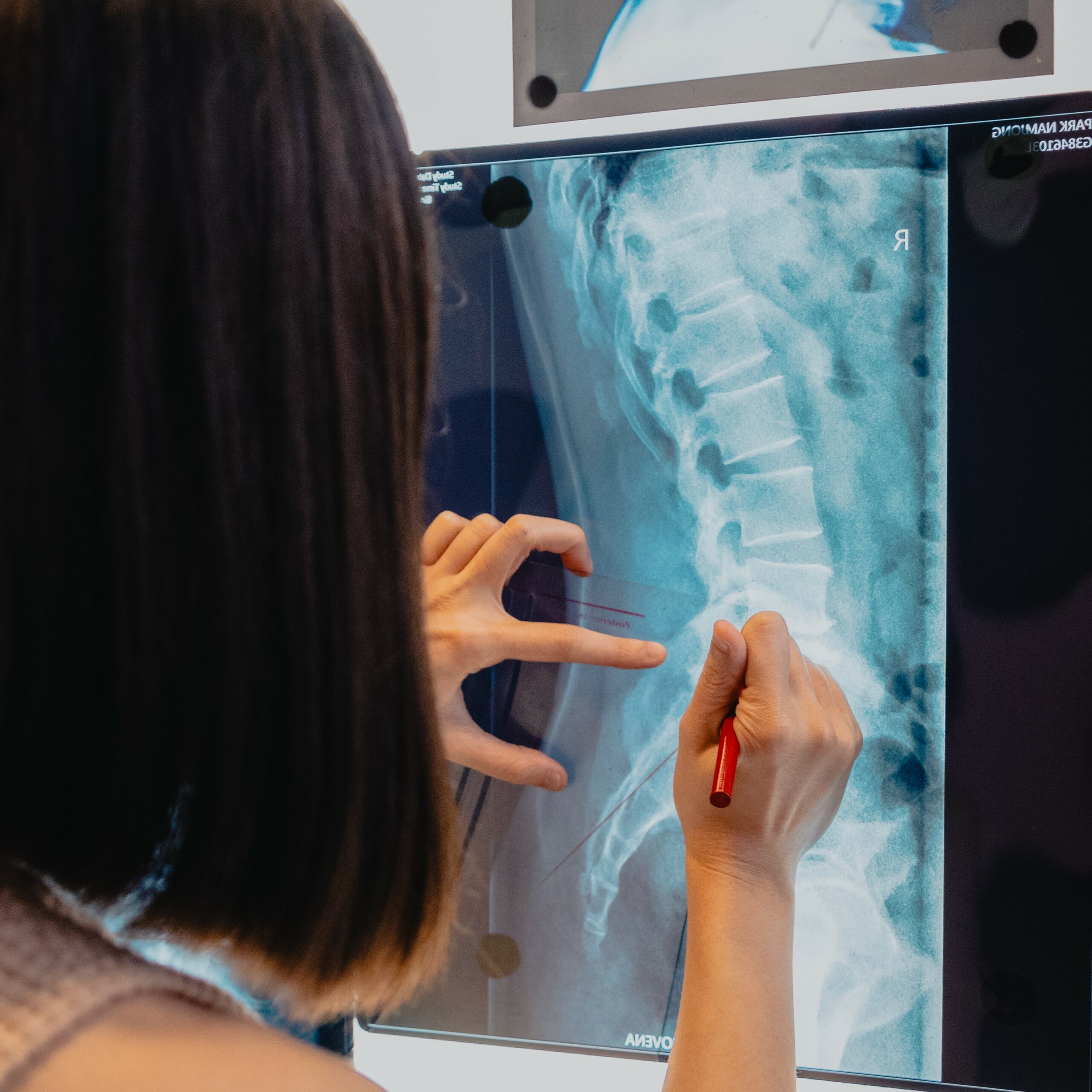 spinal x ray analysis