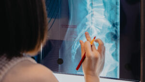 Spinal x-ray for Chiropractic care