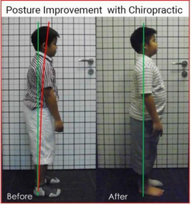 bad posture examination for children