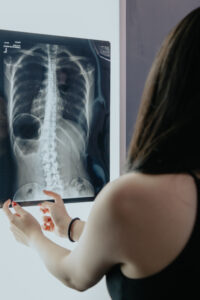 scoliosis chiropractic for families