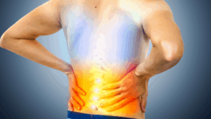 Pinched Nerve in Lower Back