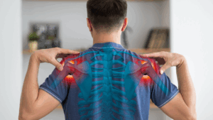 Pinched Nerve in Shoulder