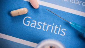 Gastritis