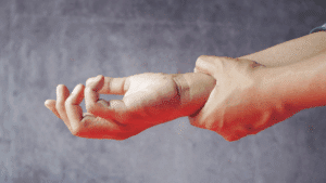 Pinched Nerve Relief: Causes, Symptoms, and Natural Care Options