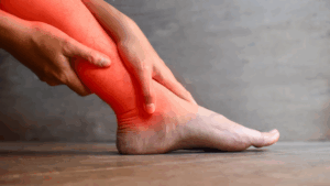 Pinched Nerve in Leg