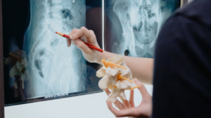 Scoliosis chiropractor