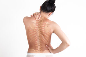 Scoliosis chiropractor