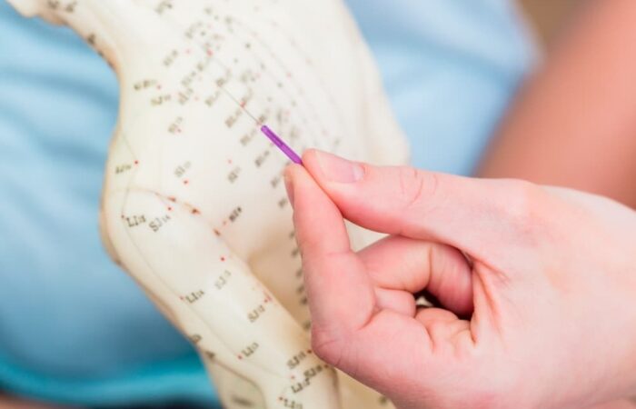Chiropractic Care or Traditional Chinese Medicine (TCM)?